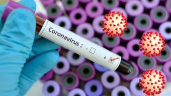 বিনামূল্যে দরিদ্রদের করোনা পরীক্ষা করবে সরকার