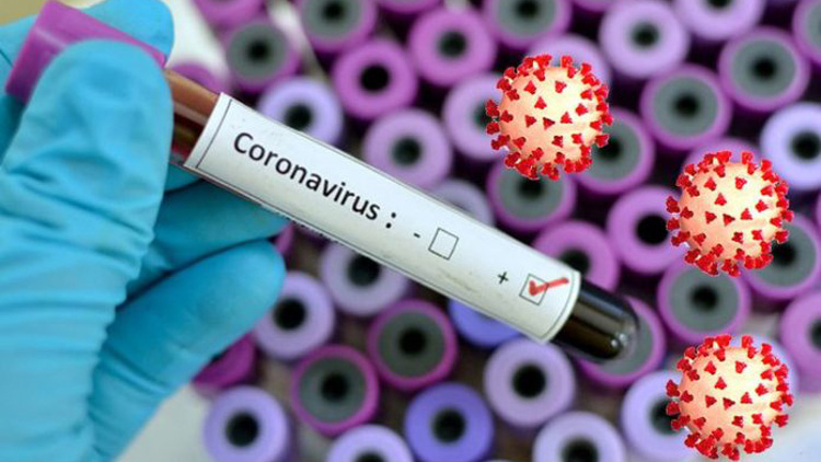 বিনামূল্যে দরিদ্রদের করোনা পরীক্ষা করবে সরকার