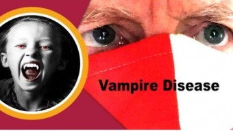 ভ্যাম্পায়ার ডিজিজ কেন হয়? জেনে নিন লক্ষণ