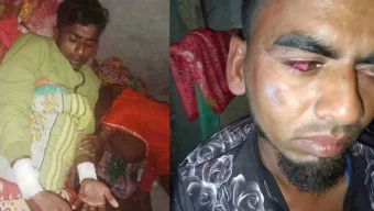 বরিশালে আওয়ামী লীগ কর্মীর চোখ তোলার চেষ্টা, রগ কাটার অভিযোগ