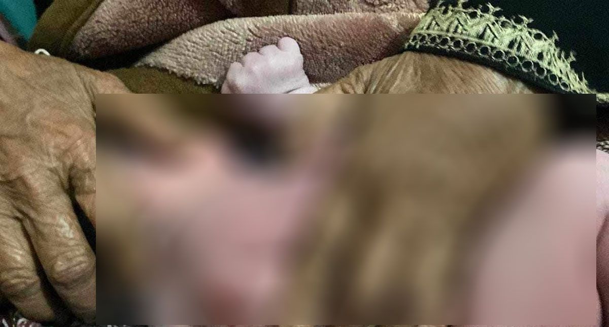 সিজারিয়ান অপারেশনে নবজাতকের পিঠ কেটে ফেললেন চিকিৎসক!