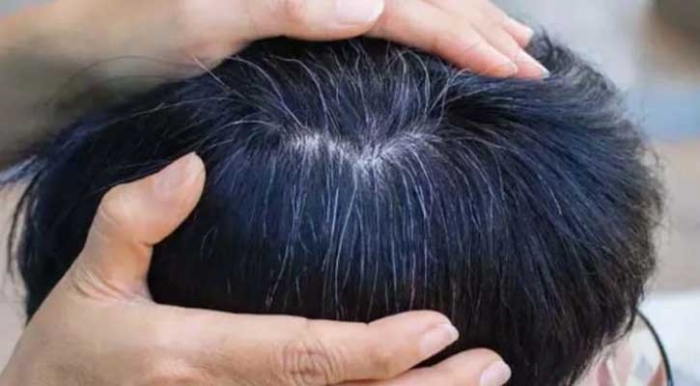 চুল পাকা রোধ করবে যে তেল