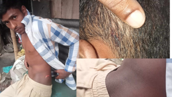 বরিশালে হাতুড়ি পেটা  করলো পাওনাদারকে