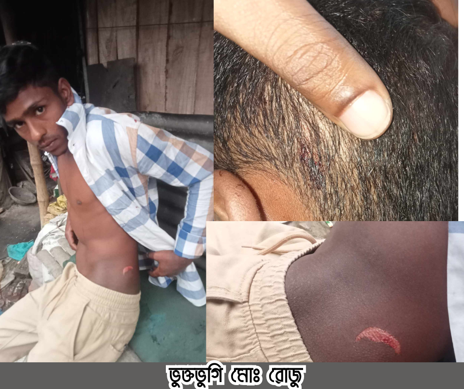 বরিশালে হাতুড়ি পেটা  করলো পাওনাদারকে