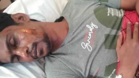 পূর্ব শত্রুতার জেরে পথ রুদ্ধ করে যুবককে পিটিয়ে জখম