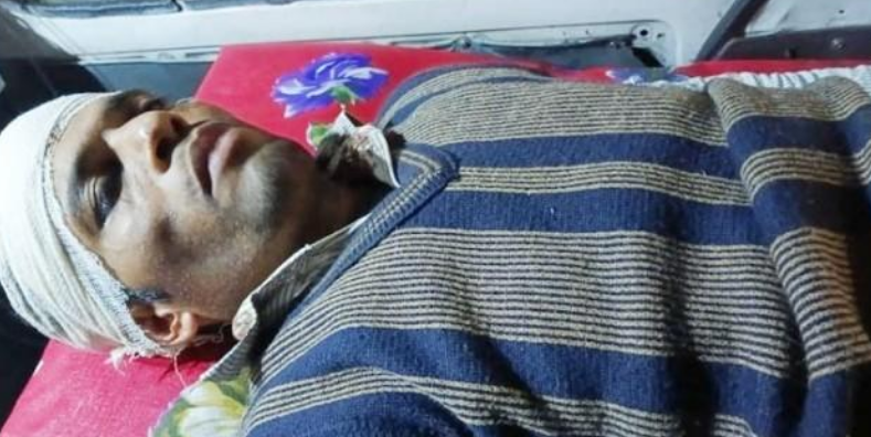 পিস্তল ঠেকিয়ে শিক্ষককে হাতুড়িপেটার অভিযোগ