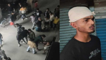 প্রেমিকাকে ‘কিউট’ বলায় বন্ধুর মাথা ফাটালো কলেজছাত্র