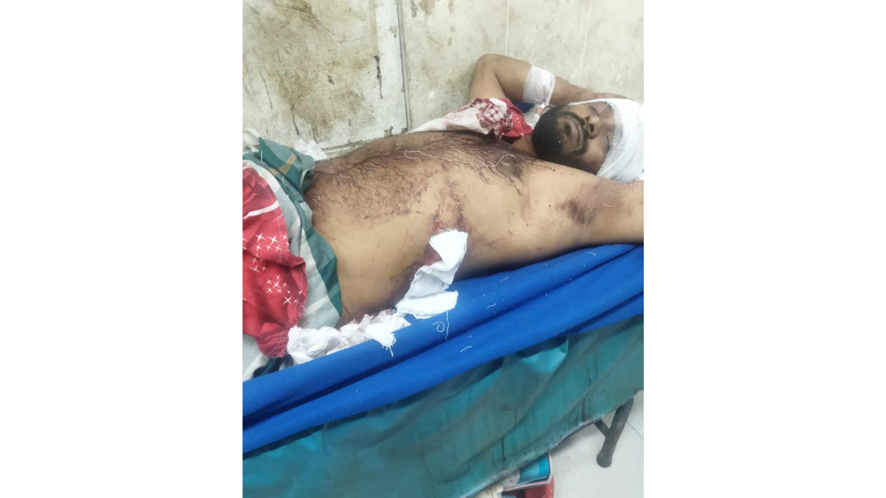 বন্ধুর বউয়ের সাথে পরকীয়ার সন্দেহে যুবককে এলাপাতাড়ী কুপিয়ে মারাত্মক জখম