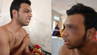 ড্রাম চুরির অভিযোগে তরুণকে মধ্যযুগীয় কায়দায় গাছে বেঁধে নির্যাতন