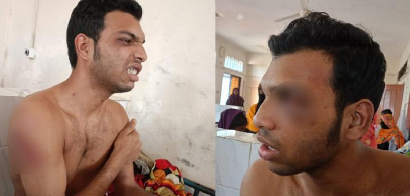 ড্রাম চুরির অভিযোগে তরুণকে মধ্যযুগীয় কায়দায় গাছে বেঁধে নির্যাতন