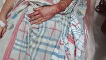 স্ত্রীকে  কুপিয়ে জখম  দায়ের কোপে পেটের ভূড়ি  বাইরে