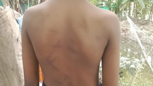 মাদরাসা ছাত্রকে পিটিয়ে জখম করার অভিযোগ