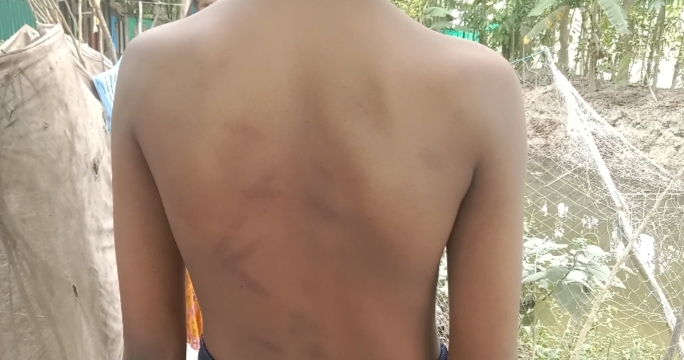 মাদরাসা ছাত্রকে পিটিয়ে জখম করার অভিযোগ