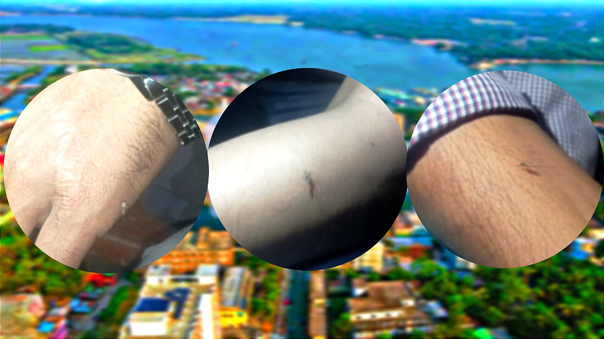 উদাসীনতায় বিসিসি,মশার উপদ্রবে অতিষ্ঠ নগরবাসী!