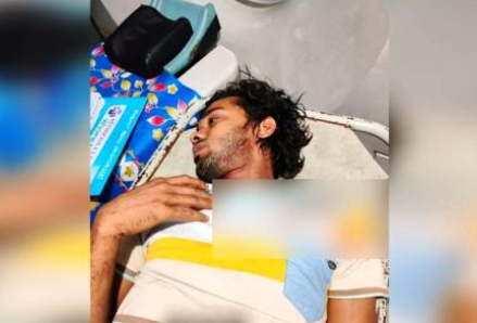 বরিশালে মাদক বিক্রিতে বাঁধা দেয়ায় যুবককে কুপিয়ে জখম