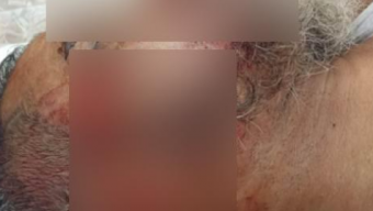 বরিশালে মোটরসাইকেল-ট্রাক মুখোমুখি সংঘর্ষে নিহত ১