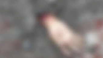 জমি নিয়ে বিরোধের ,হাতের কব্জি বিচ্ছিন্ন
