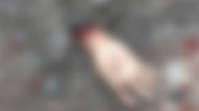 জমি নিয়ে বিরোধের ,হাতের কব্জি বিচ্ছিন্ন