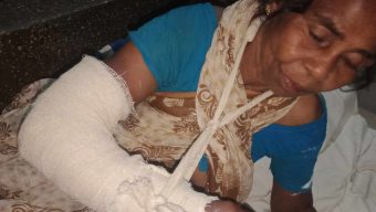 ৭০ বছরের বৃদ্ধাকে পিটিয়ে হাত ভেঙে দেয়ার  অভিযোগ।