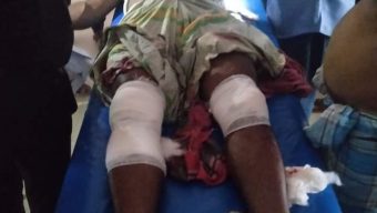 পূর্ব শক্রতার জের ধরে যুবকে  কুপিয়ে জখম