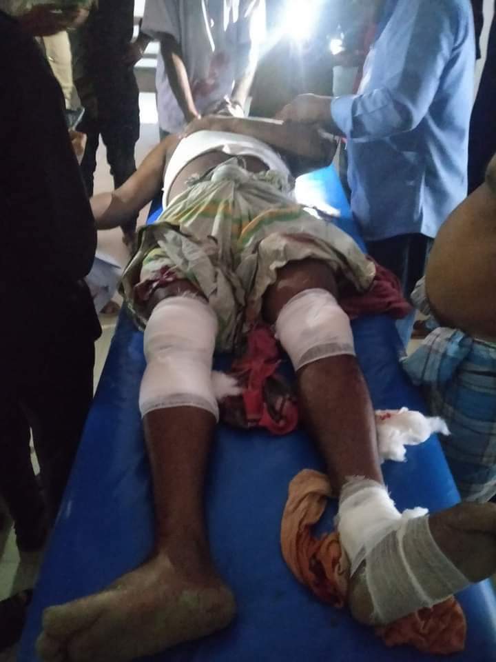 পূর্ব শক্রতার জের ধরে যুবকে  কুপিয়ে জখম