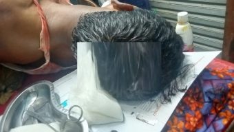 বাউফলে ইউনিয়নের প্যানেল চেয়ারম্যানকে কুপিয়ে জখম