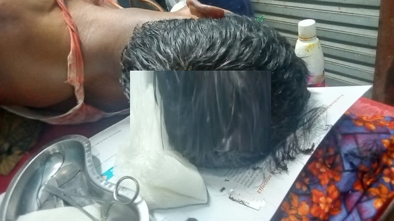 বাউফলে ইউনিয়নের প্যানেল চেয়ারম্যানকে কুপিয়ে জখম