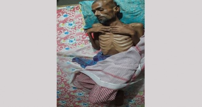 বোরহানউদ্দিনে জীবন্ত লাশ!