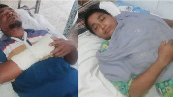 বোরহানউদ্দিনে প্রতিপক্ষের হামলায় আহত-৫