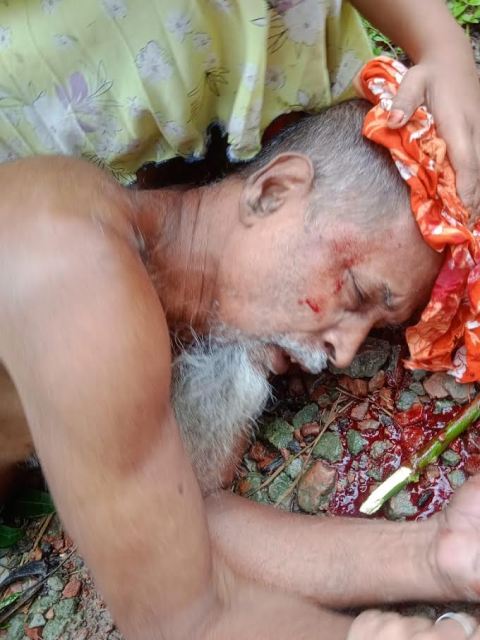 চরফ্যাশনে হামলায় আহত-৭