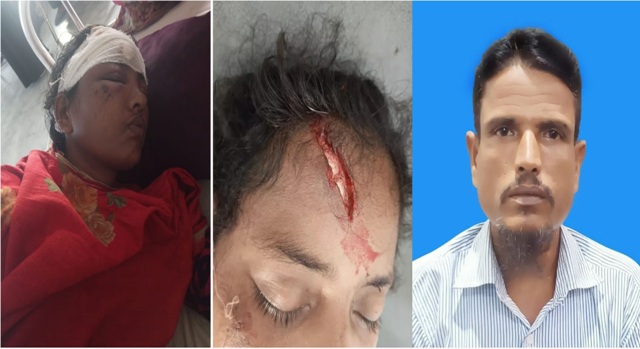 লালমোহনে মাকে মারছে ছেলে, ধরতে গিয়ে কপাল ফাটলো ভাবির