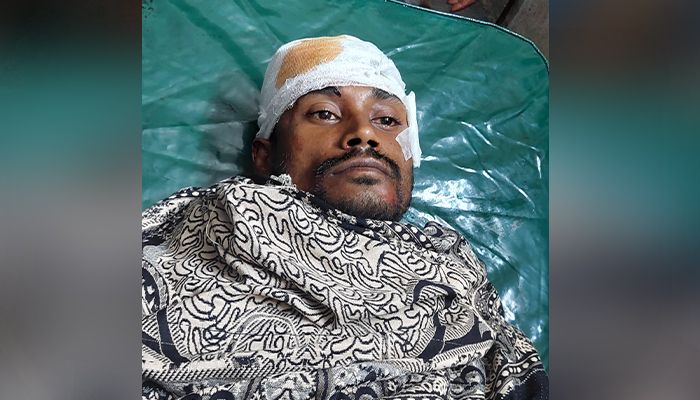 মঠবাড়িয়া ইউনিয়ন যুবদল নেতাকে কুপিয়ে জখম