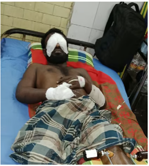 ভোলায় চুরির অভিযোগে চোখ তুলে ফেলার চেষ্টা