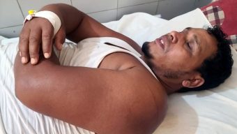 তজুমদ্দিনে ব্যবসায়ীকে কুপিয়ে জখম