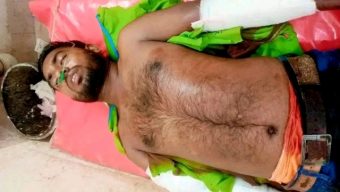 কলাপাড়ায় মোটরসাইকেল চালকের উপর সন্ত্রাসী হামলা