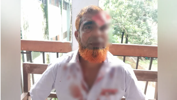 ঝালকাঠিতে আদালত চত্বরে হত্যা মামলার সাক্ষীকে হাতুড়িপেটা