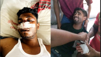 বরিশালে আওয়ামী লীগ সমর্থকদের হামলায় ছাত্রদল নেতাসহ ৫ জন আহত