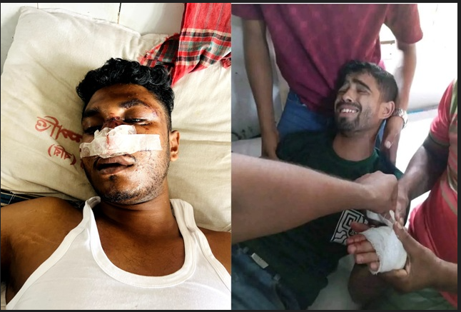 বরিশালে আওয়ামী লীগ সমর্থকদের হামলায় ছাত্রদল নেতাসহ ৫ জন আহত