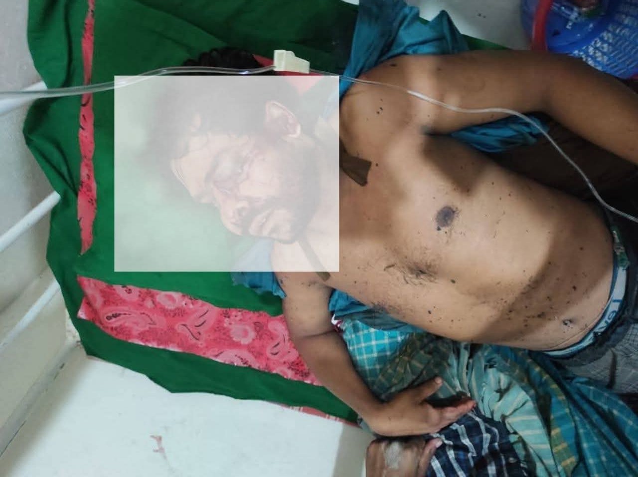 বেতাগীতে ছিনতাইয়ের কবলে বিকাশ ব্যবসায়ী  রক্তাক্ত জখম