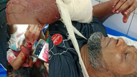 বাবুগঞ্জে জমি নিয়ে বিরোধে নারীসহ ৪ জনকে গুরুতর জখম, ১০ দিনেও গ্রেফতার হয়নি কেউ