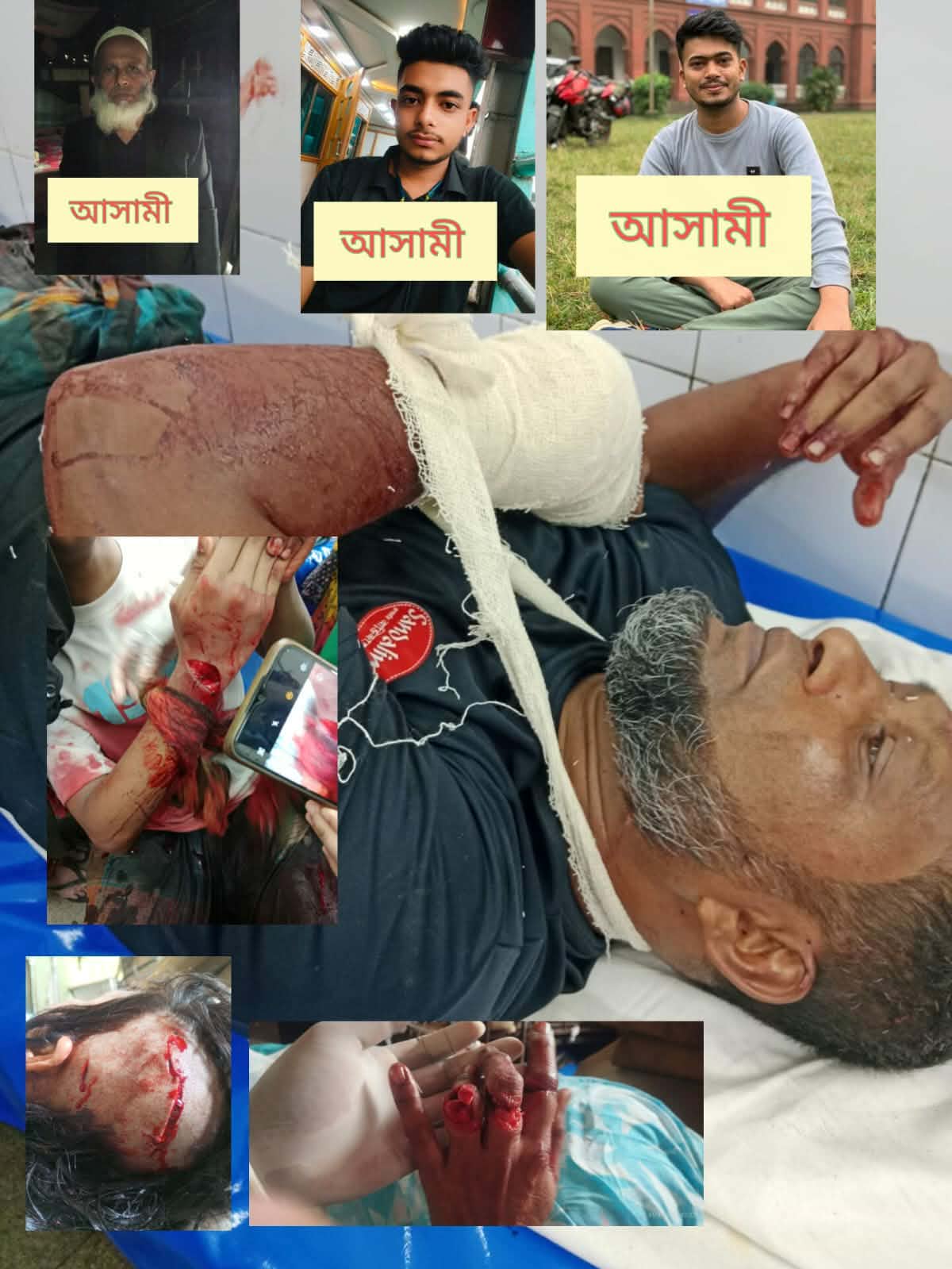 বাবুগঞ্জে জমি নিয়ে বিরোধে নারীসহ ৪ জনকে গুরুতর জখম, ১০ দিনেও গ্রেফতার হয়নি কেউ